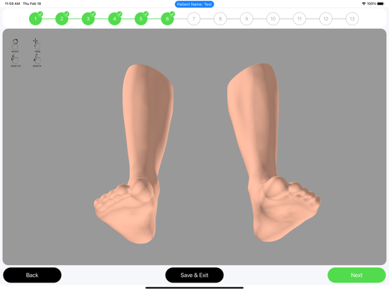 Screenshot #5 pour Ortesi Foot & Ankle