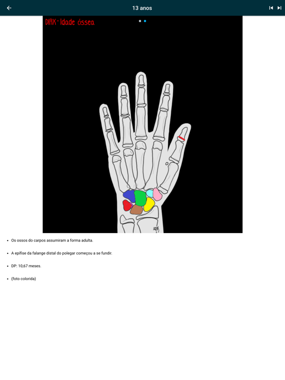 DIAX - Bone Age iPad screenshot 7 - Medical app