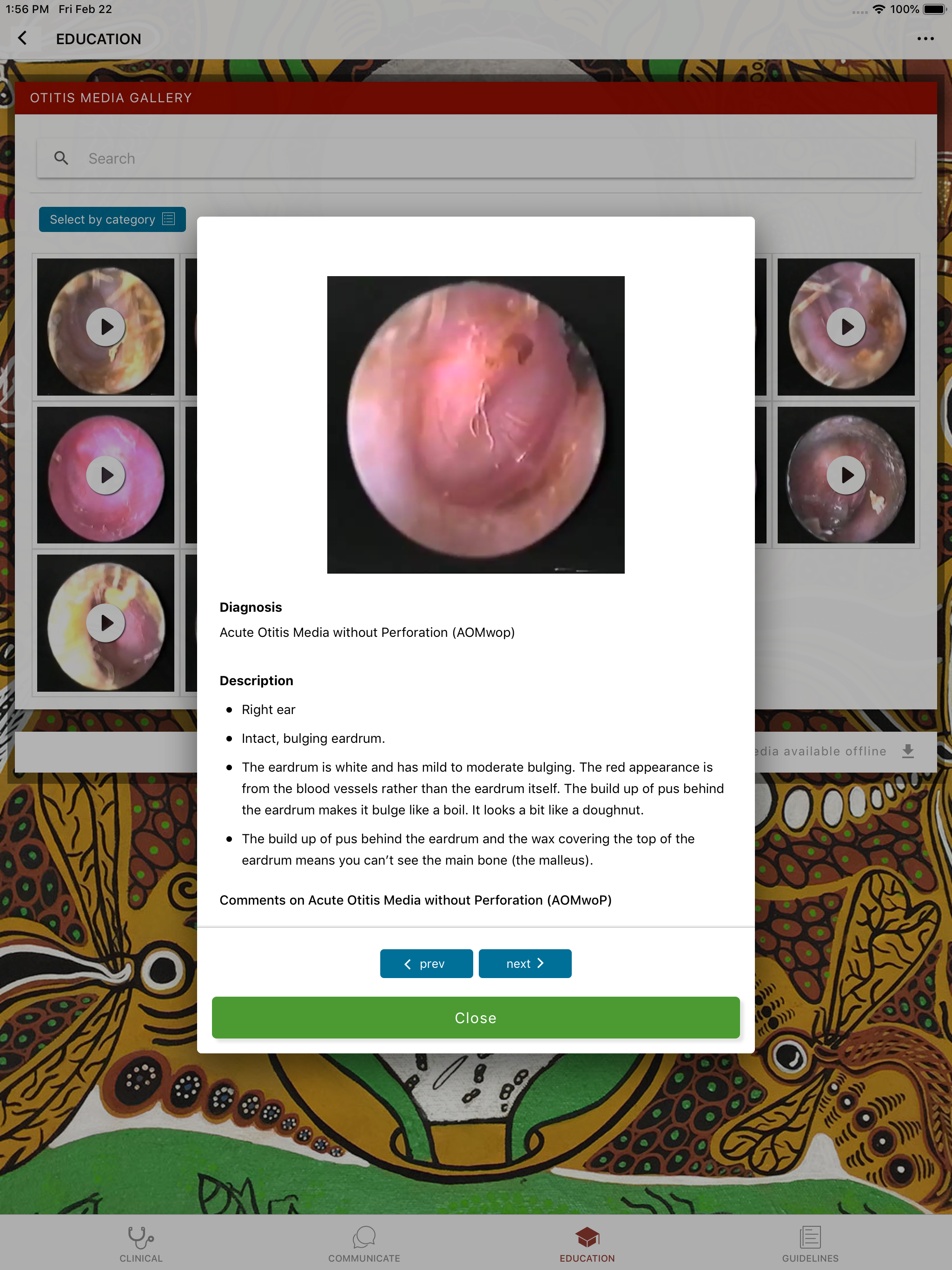 Otitis Media Guidelines