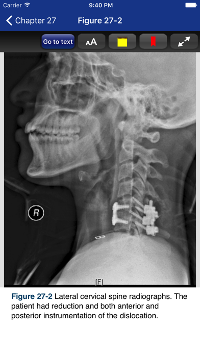 The NeuroICU Book, 2/Eのおすすめ画像4