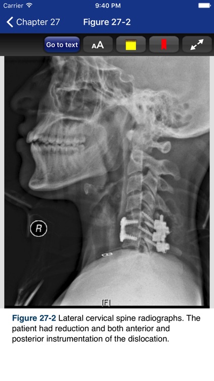 The NeuroICU Book, 2/E screenshot-3