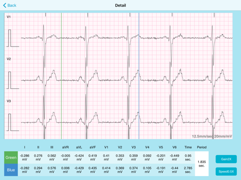 QT ECG Lite screenshot 4