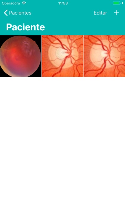 Retina Fácil screenshot-3