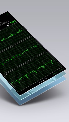 心電図ブック - ECG (EKG) Booksのおすすめ画像3