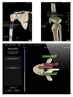 Skeleton System Pro III iPad image 3