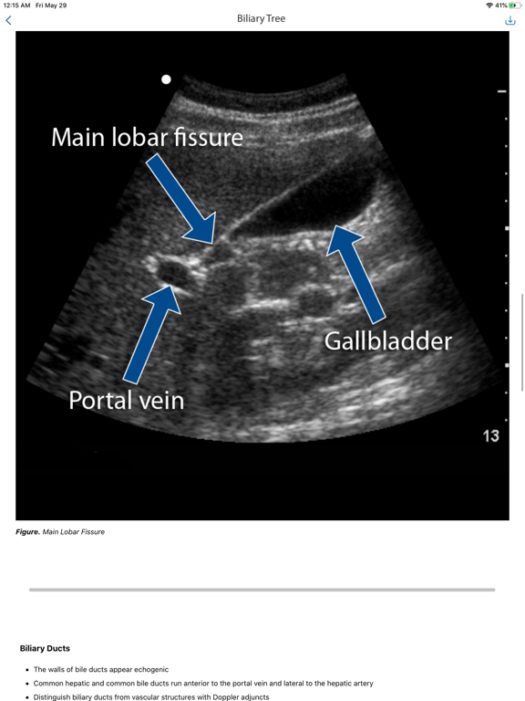 SonoSim iPad screenshot 5 - Medical app