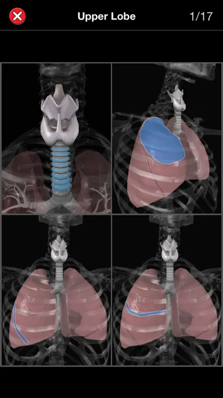 Anatomy Quiz Pro screenshot 5 of 5