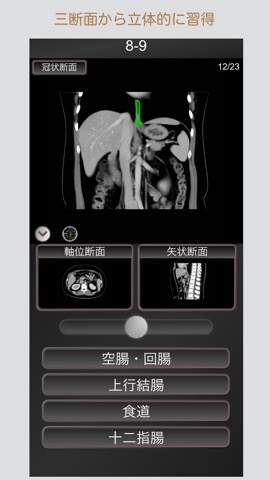 CT PassQuiz 腹部 / 断面図/解剖 /MRIのおすすめ画像3