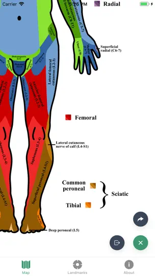 Captura de pantalla de Dermatomes en iPhone 2