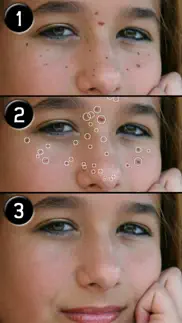 pimple eraser lite iphone resimleri 3