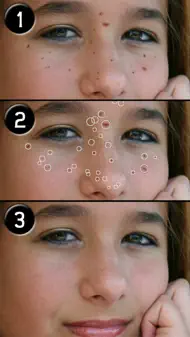 Pimple Eraser LITE iphone bilder 2