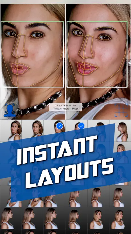 Treatment Pad AI Layout Camera