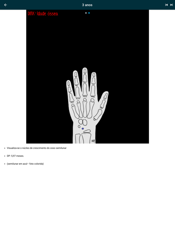 DIAX - Bone Age iPad screenshot 10 - Medical app