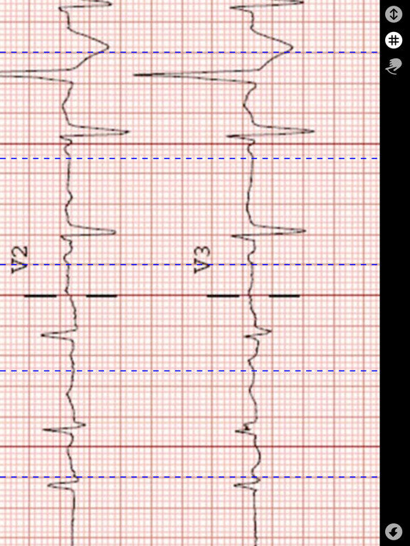Screenshot #6 pour Compas ECG