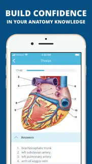usmle clinical anatomy quiz iphone screenshot 4