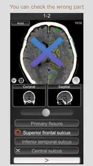 ct passquiz head/brain / mri iphone screenshot 2