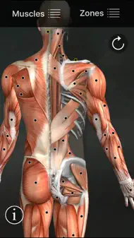 Muscle Trigger Points iphone bilder 1