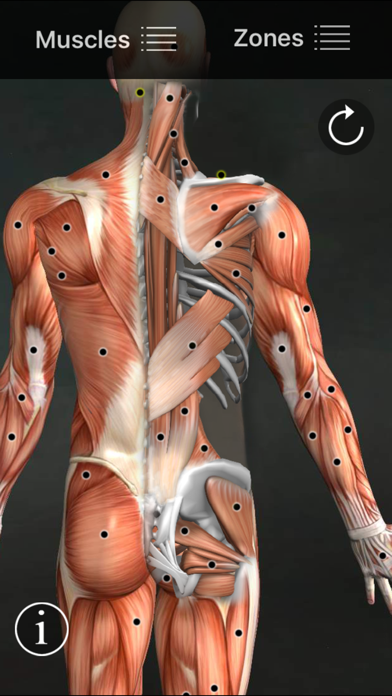 Muscle Trigger Points Screenshot