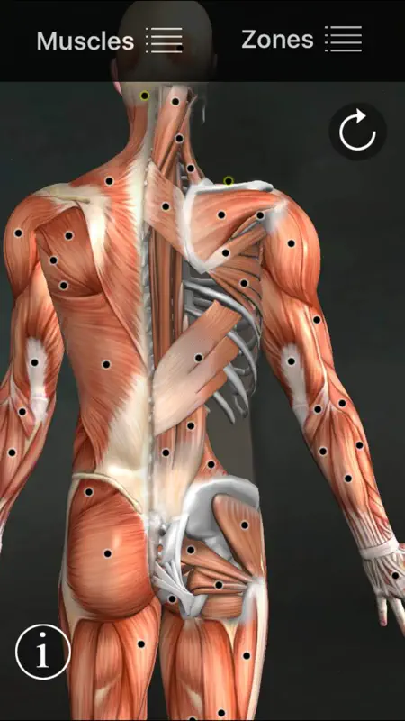 Muscle Trigger Points screenshot 1 of 5