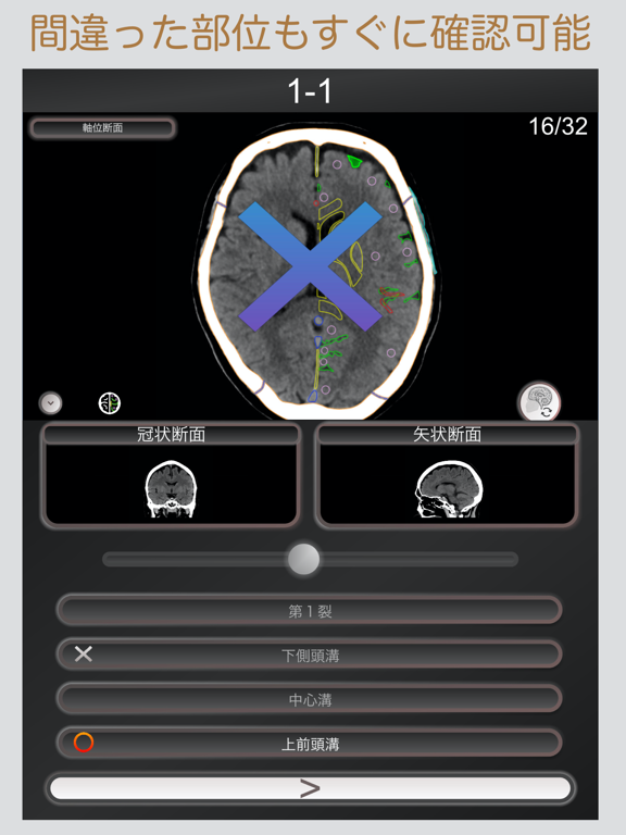 CT PassQuiz 頭部/脳 /CT断面図解剖MRIのおすすめ画像2