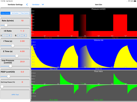 VentSim iPad app afbeelding 4