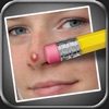 Pimple Eraser icon