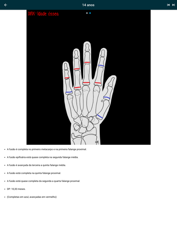 DIAX - Bone Age iPad screenshot 8 - Medical app