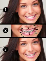 brace face ipad resimleri 1