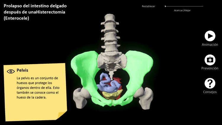 myProlapse screenshot-5