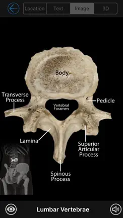 Skeletal Anatomy 3D iPhone image 2