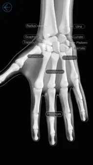 Skeletal Anatomy 3D iphone bilder 0