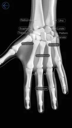 Skeletal Anatomy 3D iPhone image 1