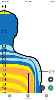 dermatomes iphone screenshot 3