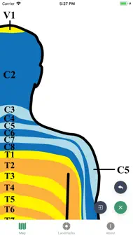 Dermatomes iphone bilder 3