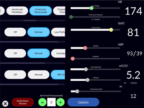 Simpl Patient Monitor iPad screenshot 2