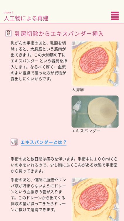 乳房再建への道しるべ Plus