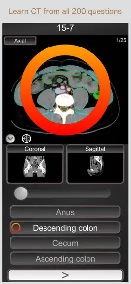 Game screenshot CT PassQuiz Abdomen / MRI mod apk