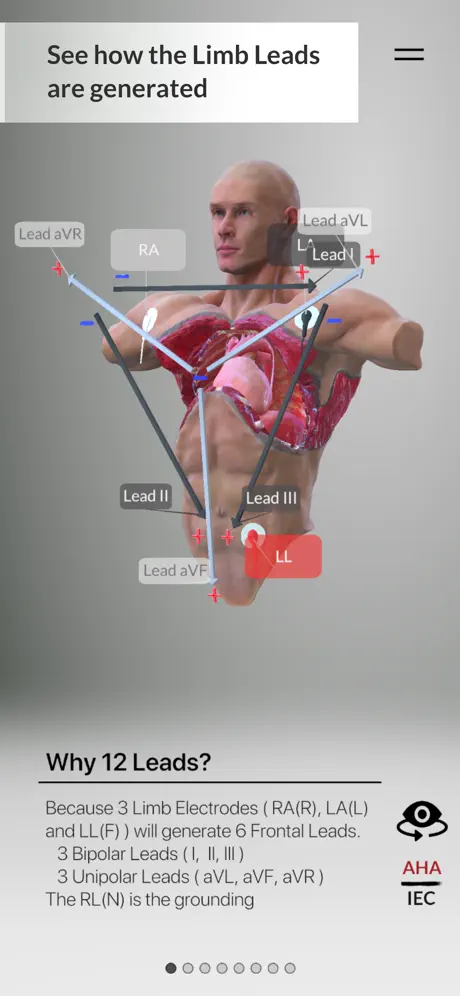 3D ECG Leads