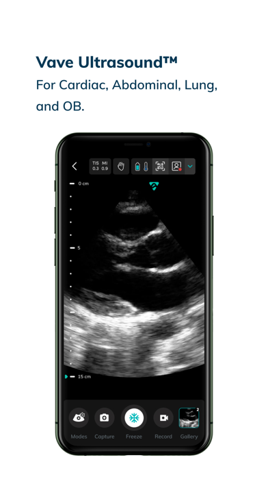 Vave Wireless Ultrasound Screenshot