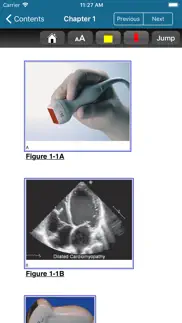 How to cancel & delete atlas emergency ultrasound, 2e 4