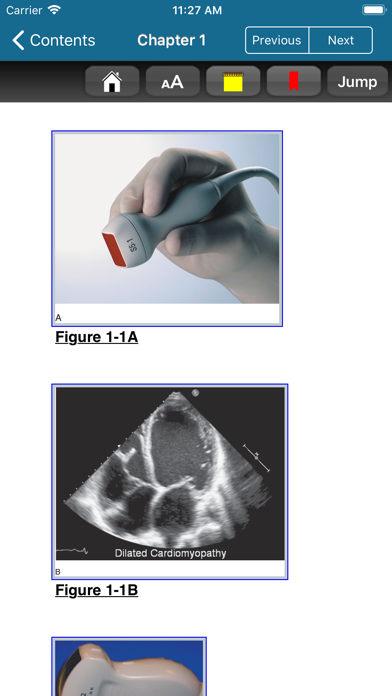 Atlas Emergency Ultrasound, 2E Screenshot