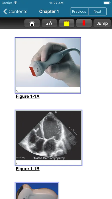 Atlas Emergency Ultrasound, 2E screenshot 5 of 10