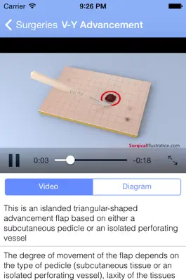 Game screenshot Surgical Flaps apk