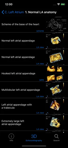 Game screenshot CARDIO3® 3D Echocardiography apk
