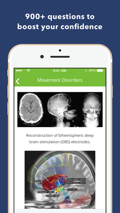 Neurology Exam Review Q&A Screenshot