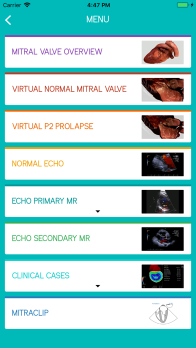 Mitral View Screenshot