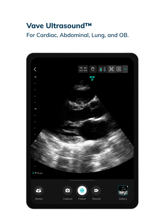 Vave Wireless Ultrasoundのおすすめ画像2