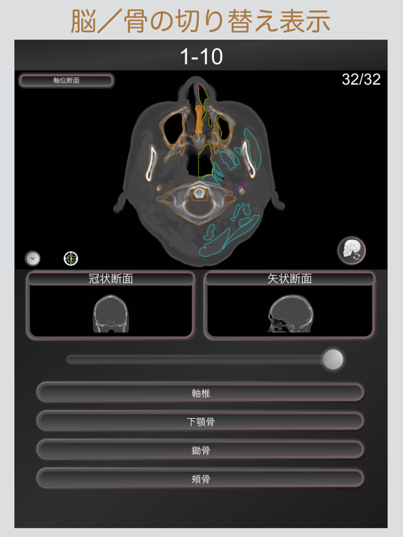 CT PassQuiz 頭部/脳 /CT断面図解剖MRIのおすすめ画像4