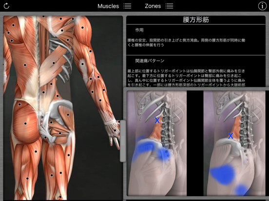 筋のトリガーポイントのおすすめ画像4