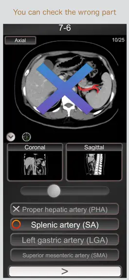 Game screenshot CT PassQuiz Abdomen / MRI apk